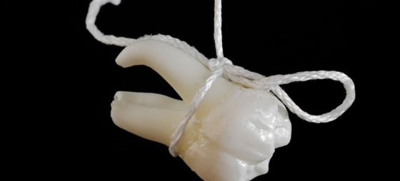 34901bd6f1a7df2808aebaa21df1ceef