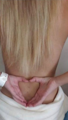 Josefine Sydness 20 aar og under cellegiftbehandling B