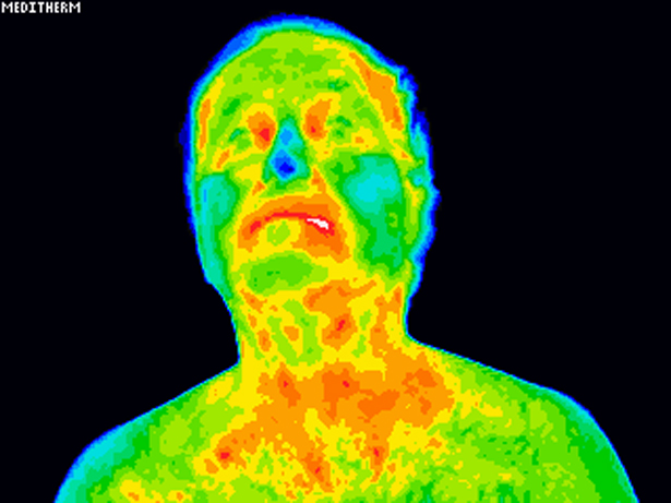 harols.tif2015.11.12 10.13.15