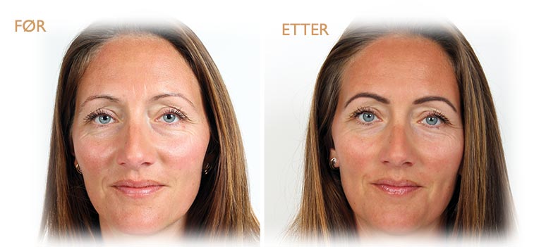 helse-permanentMakeup