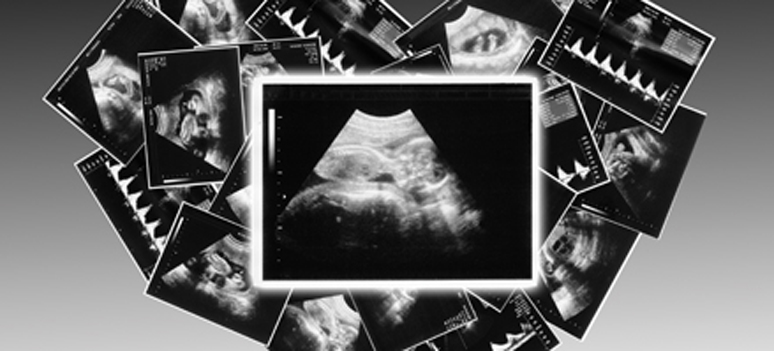 shutterstock 91404482